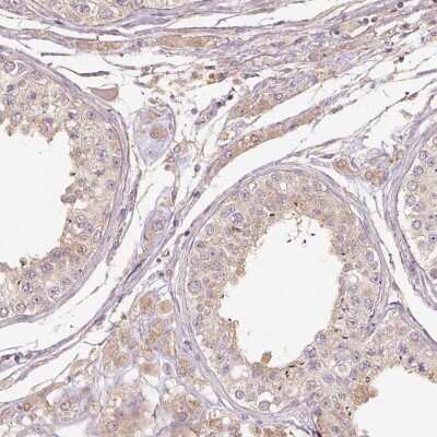 Immunohistochemistry-Paraffin: RB1CC1 Antibody [NBP2-47312]