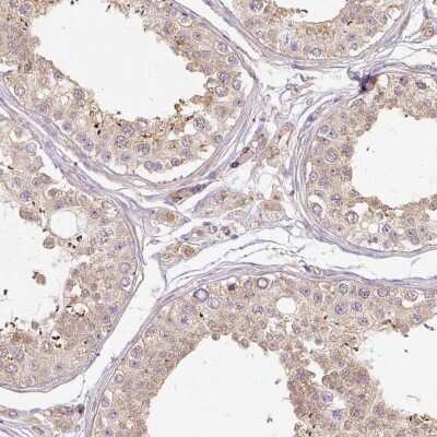 Immunohistochemistry-Paraffin: RB1CC1 Antibody [NBP2-48572]