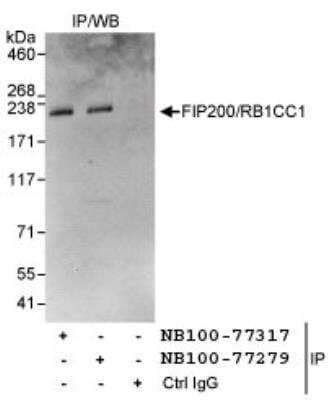 Immunoprecipitation: RB1CC1 Antibody [NB100-77317]