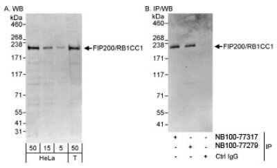 Western Blot: RB1CC1 Antibody [NB100-77279]