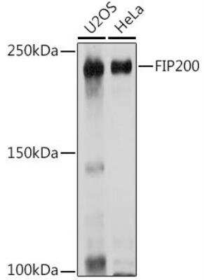 Western Blot: RB1CC1 AntibodyAzide and BSA Free [NBP2-93785]