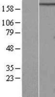 Western Blot: RB1CC1 Overexpression Lysate [NBL1-15184]