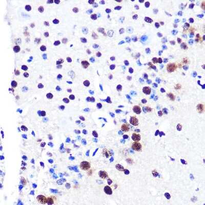 Immunohistochemistry-Paraffin: RBBP4/RbAp48 Antibody (0D1X1) [NBP3-16237]