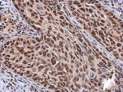 Immunohistochemistry-Paraffin: RBBP4/RbAp48 Antibody (15G12) [NBP1-41202]