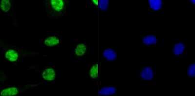 Immunocytochemistry/ Immunofluorescence: RBBP4/RbAp48 Antibody (JU37-47) [NBP2-75642]