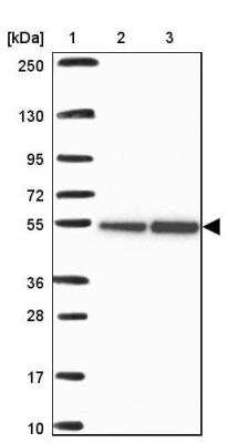 Western Blot: RBBP4/RbAp48 Antibody [NBP2-46858]