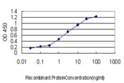 ELISA: RBBP6 Antibody (5A11) [H00005930-M01]
