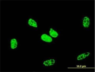 Immunocytochemistry/ Immunofluorescence: RBBP6 Antibody (5A11) [H00005930-M01]