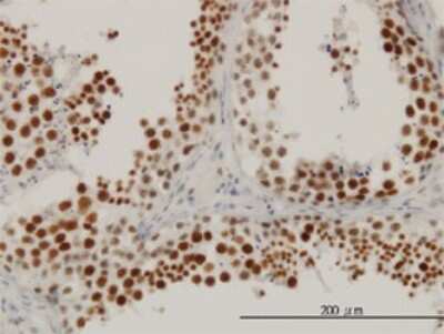 Immunohistochemistry-Paraffin: RBBP6 Antibody (5A11) [H00005930-M01]