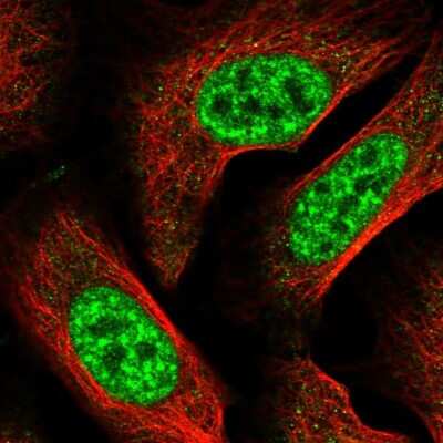 Immunocytochemistry/ Immunofluorescence: RBBP6 Antibody [NBP2-47311]