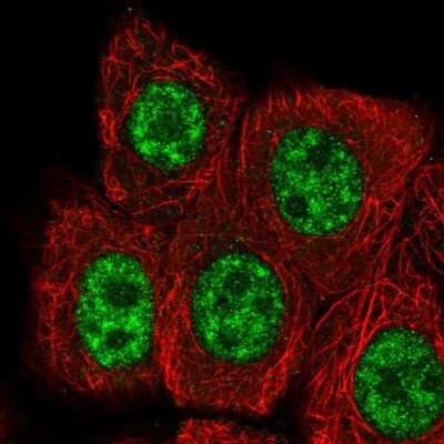 Immunocytochemistry/ Immunofluorescence: RBBP6 Antibody [NBP2-58777]