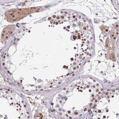 Immunohistochemistry: RBBP6 Antibody [NBP2-47311]