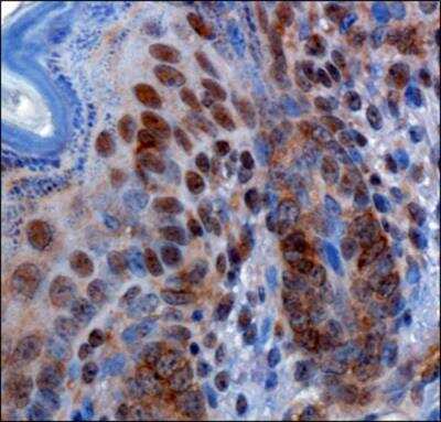 Immunohistochemistry-Paraffin: RBBP6 Antibody - BSA Free [NBP1-49535]