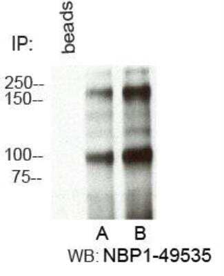 Immunoprecipitation: RBBP6 Antibody - BSA Free [NBP1-49535]