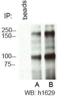 Immunoprecipitation: RBBP6 Antibody - BSA Free [NBP1-49542]