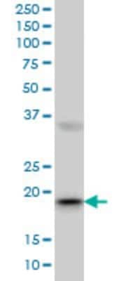 Western Blot: RBBP9 Antibody (2A11) [H00010741-M01]