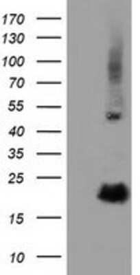 Western Blot: RBBP9 Antibody (OTI4G3) [NBP2-03025]