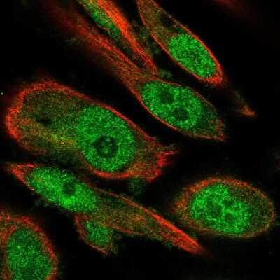 Immunocytochemistry/ Immunofluorescence: RBBP9 Antibody [NBP2-55018]