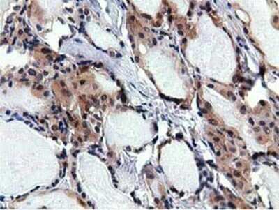Immunohistochemistry: RBBP9 Antibody (OTI4G3) - Azide and BSA Free [NBP2-73828]
