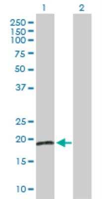 Western Blot: RBBP9 Antibody [H00010741-D01F]