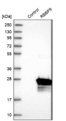 Western Blot: RBBP9 Antibody [NBP1-88553]