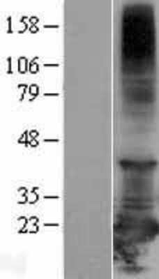 Western Blot: RBBP9 Overexpression Lysate [NBL1-15186]