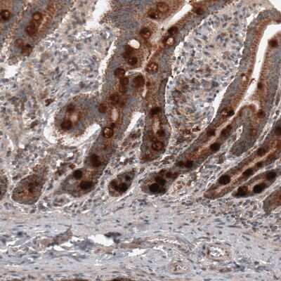 Immunohistochemistry-Paraffin: RBCK1 Antibody (CL4289) [NBP2-59048]
