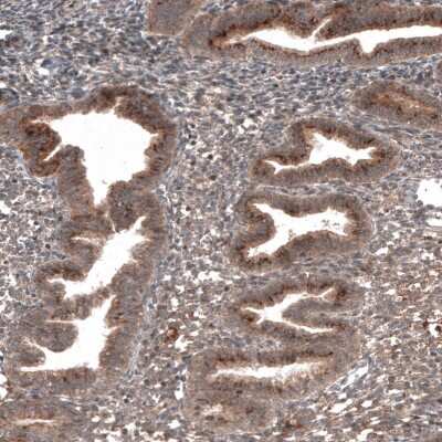 Immunohistochemistry-Paraffin: RBCK1 Antibody (CL4289) [NBP2-59048]