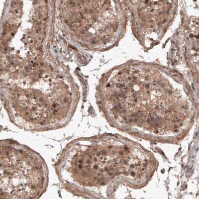 Immunohistochemistry-Paraffin: RBCK1 Antibody (CL4289) [NBP2-59048]