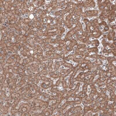 Immunohistochemistry-Paraffin: RBCK1 Antibody (CL4289) [NBP2-59048]