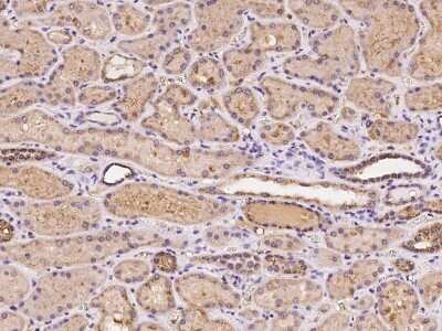 Immunohistochemistry-Paraffin: RBCK1 Antibody [NBP2-98085]