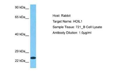 Western Blot: RBCK1 Antibody [NBP2-88131]