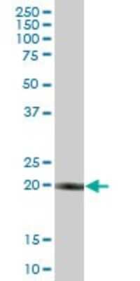 Western Blot: RBED1 Antibody [H00084173-B01P]