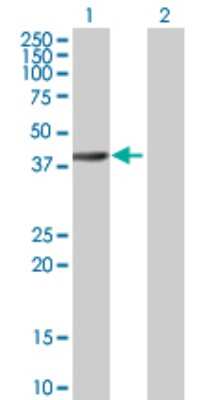 Western Blot: RBED1 Antibody [H00084173-B01P]