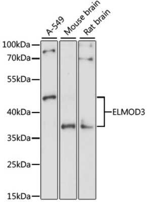 Western Blot: RBED1 AntibodyAzide and BSA Free [NBP2-93265]