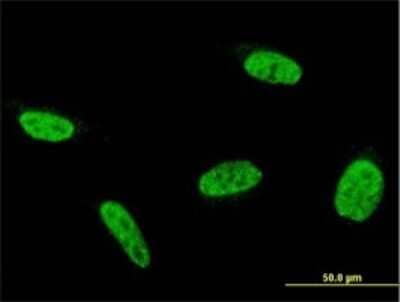 Immunocytochemistry/ Immunofluorescence: RBEL1 Antibody (2E11-1F10) [H00055684-M01]