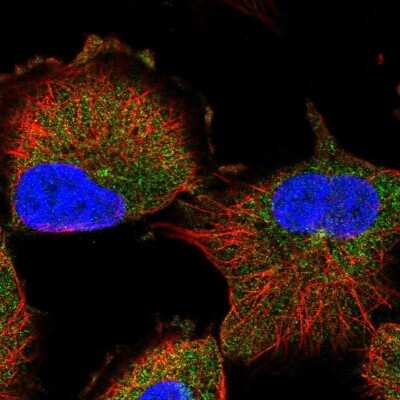 Immunocytochemistry/ Immunofluorescence: RBEL1 Antibody [NBP1-91741]