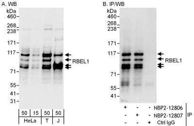 Immunoprecipitation: RBEL1 Antibody [NBP2-12806]