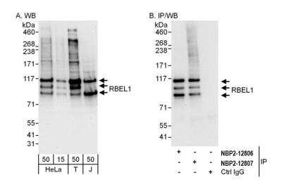 Western Blot: RBEL1 Antibody [NBP2-12807]