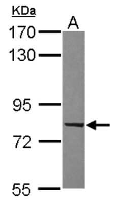 Western Blot: RBEL1 Antibody [NBP2-20098]