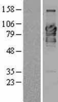 Western Blot: RBEL1 Overexpression Lysate [NBL1-08605]