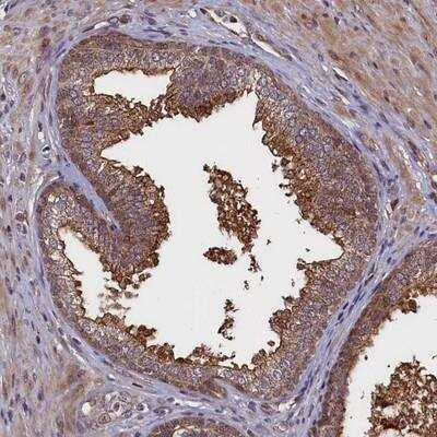 Immunohistochemistry-Paraffin: RBFA Antibody [NBP1-88470]