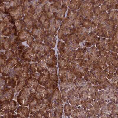 Immunohistochemistry-Paraffin: RBFA Antibody [NBP1-88471]