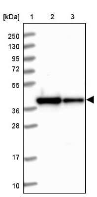 Western Blot: RBFA Antibody [NBP1-88471]