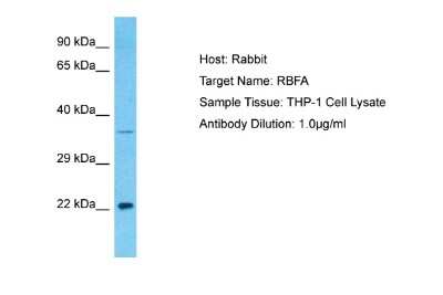 Western Blot: RBFA Antibody [NBP2-87996]