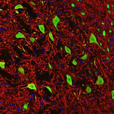 Immunohistochemical Staining of RBFOX3/NeuN in Paraffin Embedded Rat Brain Stem