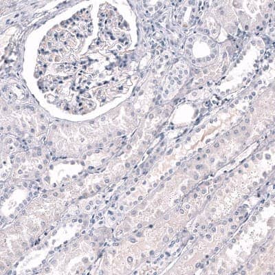 Immunohistochemistry-Paraffin: RBFOX3/NeuN Antibody (CL11892) [NBP3-15124]