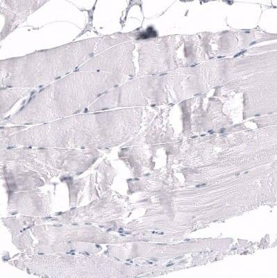 Immunohistochemistry-Paraffin: RBFOX3/NeuN Antibody (CL11892) [NBP3-15124]