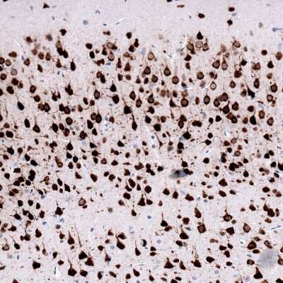 Immunohistochemistry-Paraffin: RBFOX3/NeuN Antibody (CL11892) [NBP3-15124]