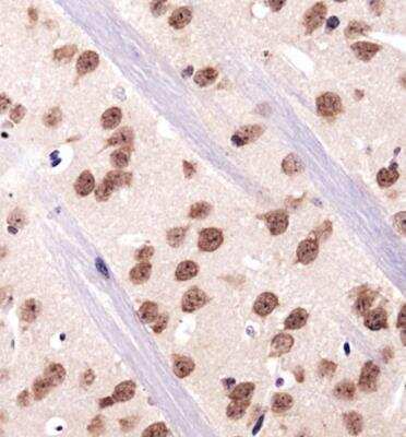 Immunohistochemistry: RBFOX3/NeuN Antibody - BSA Free [NBP1-77686]